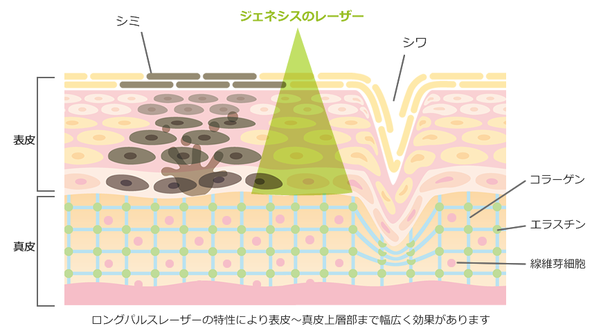 ジェネシスの効果