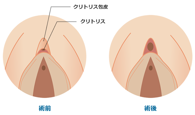 術前術後