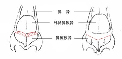 施術のイメージ1