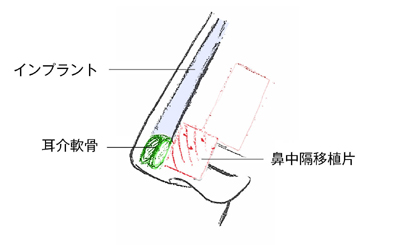 施術のイメージ3