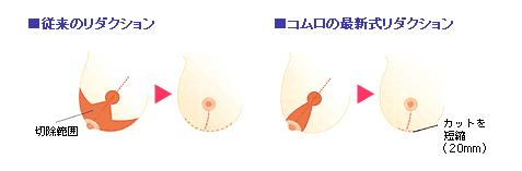 コムロ式リダレクションイメージ図