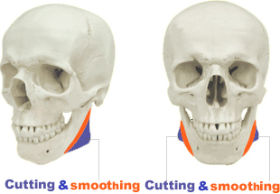 削骨とスムースィングイメージ