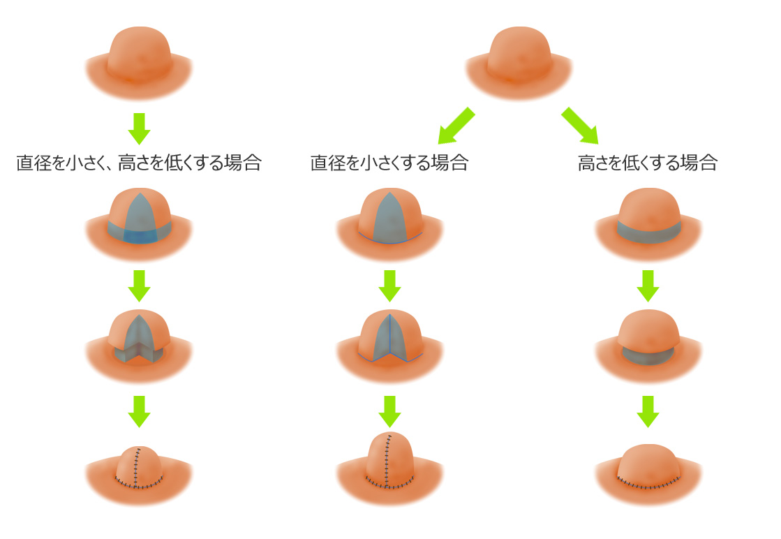 乳頭縮小術の図解